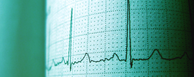 cardiogram detail.