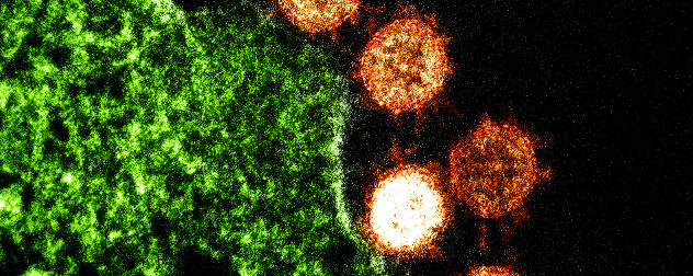 Transmission Electron Micrograph (TEM) of Severe Acute Respiratory Syndrome (SARS) virus.