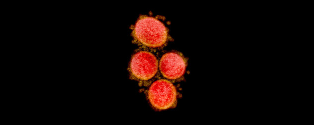 Transmission electron micrograph of SARS-CoV-2 virus particles, isolated from a patient.